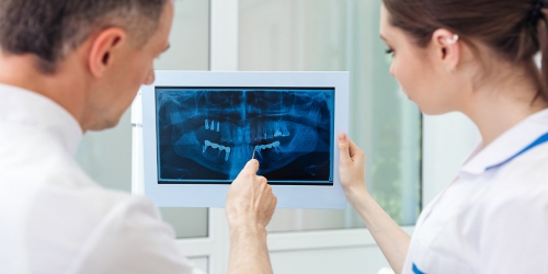radiografia-arcate-dentali