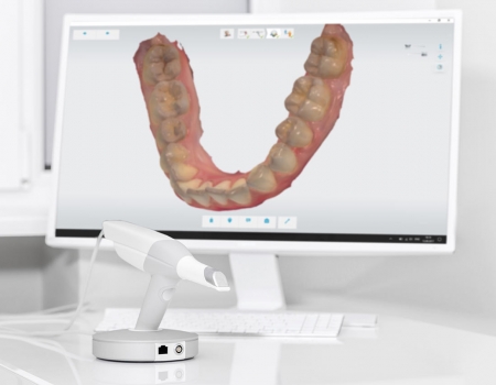 scanner-intraorale-3d